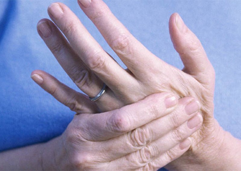 Preskakanje prsta na ruci nije uobičajena pojava