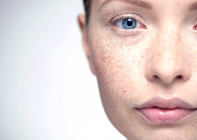Što izgled kože lica govori o vašem zdravlju