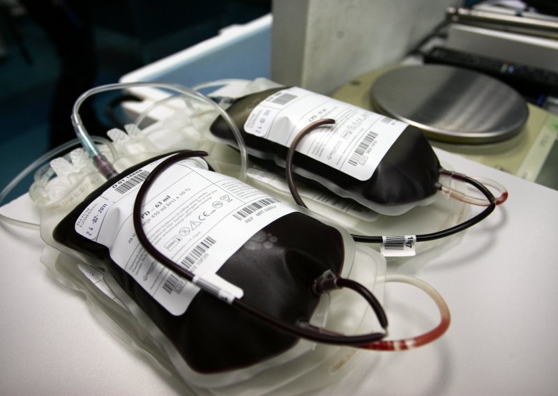 KBC-u Rijeka nedostaje krvi, pozivaju na hitno davanje