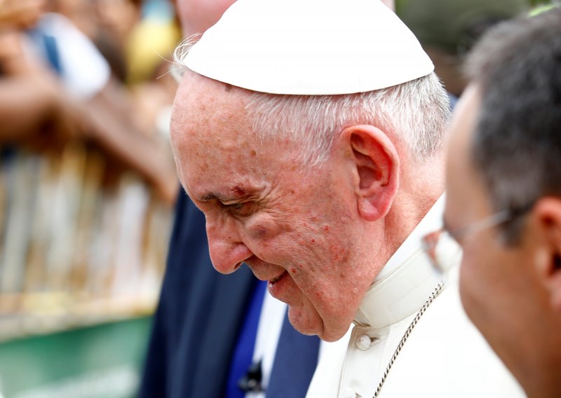 Papa udario glavom o staklo, zaradio posjekotinu i modricu