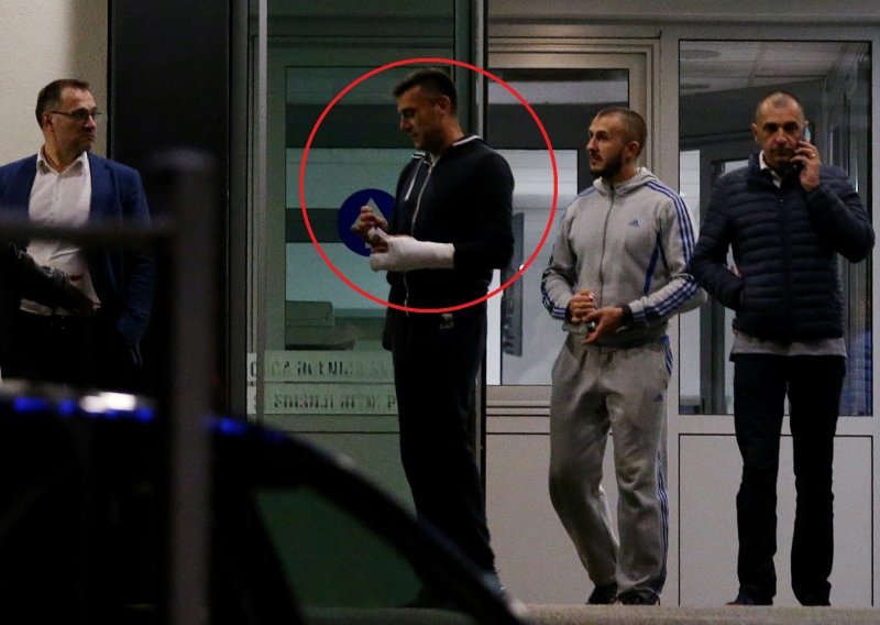 Prve fotografije brutalno pretučenog trenera Dinama; slomljena mu je ruka