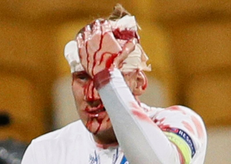 Krvava ozljeda Domagoja Vide šokirala gledatelje u Kijevu!