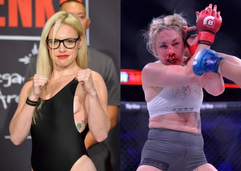 Lijepa boksačica ušla je u MMA ring, a onda ju je protivnica - unakazila