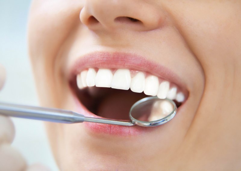 Zašto bijele mrlje nisu dobre za zdravlje zubi?