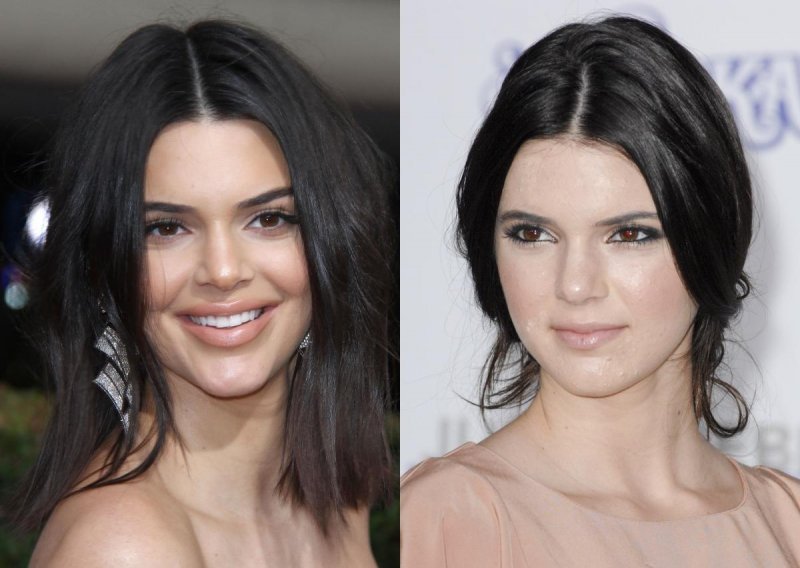 Žrtva ismijavanja: Kendall Jenner na crvenom tepihu osvanula s napumpanim usnama i oronulim tenom