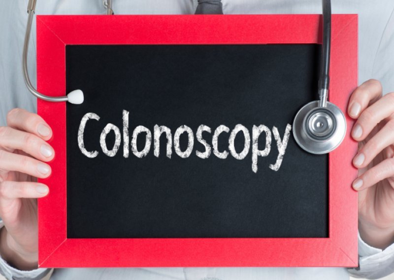 Sve što ste željeli znati o kolonoskopiji, a niste se usudili pitati