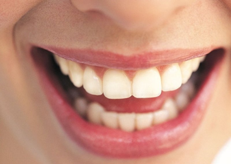 Kako vam zubi mogu pomoći u igri zavođenja?