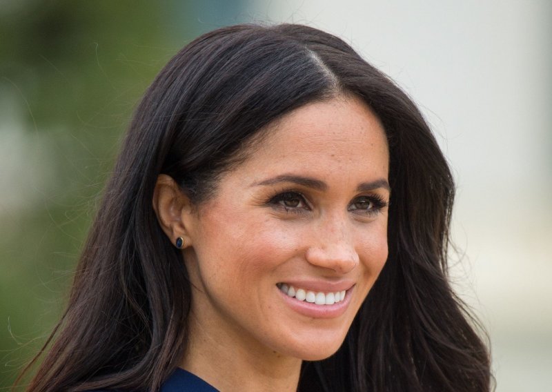 Sve više žena podvrgava se plastičnim operacijama kako bi izgledale kao Meghan Markle