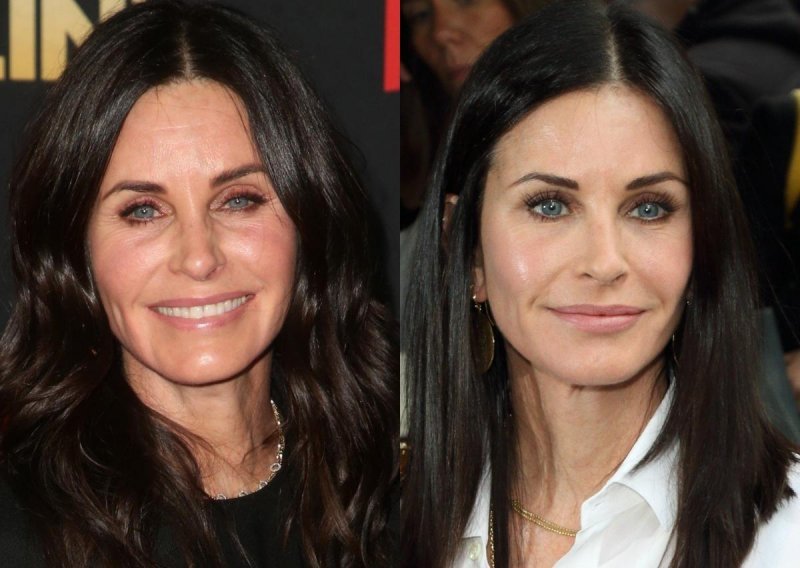 Courteney Cox iskreno o starenju i filerima kojima je zamalo uništila lice: 'Više nisam sličila na sebe'