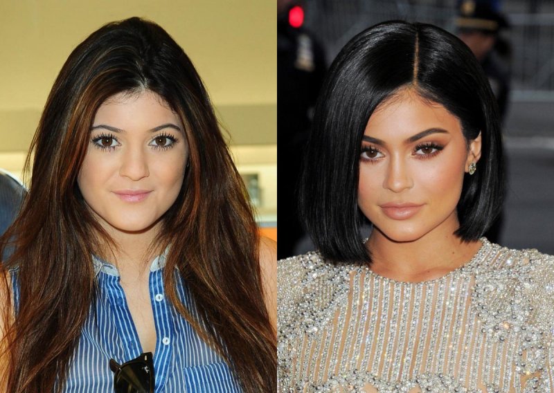 Kylie Jenner tvrdi kako se nikad nije podvrgla kozmetičkoj operaciji