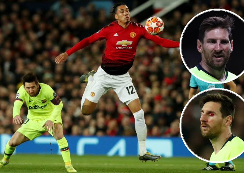 Svi su se zabrinuli kad je Smalling 'preuredio' Lea Messija; iz Barcelone su sada objavili detalje njegove ozljede