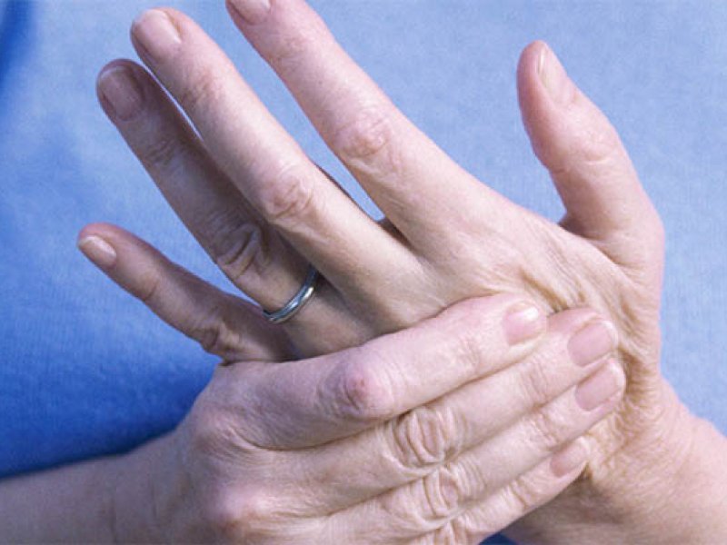 Zašto se javljaju bolovi u zglobovima prstiju i kako se liječe?