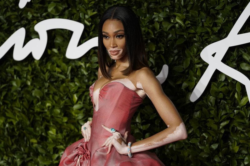 Winnie Harlow