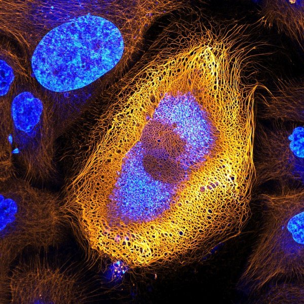 1. Besmrtne stanice ljudske kože (HaCaT keratinociti) izražene fluorescentno obilježenim keratinom (40x)