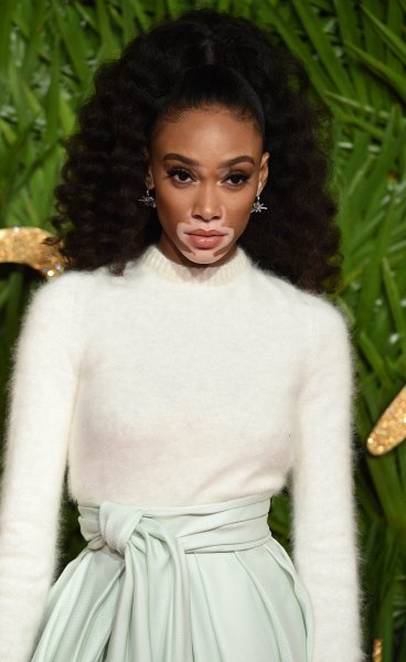 Winnie Harlow