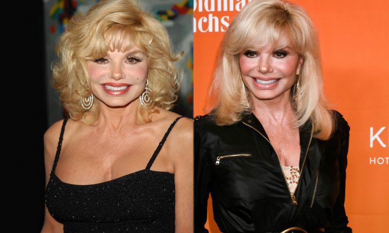 Loni Anderson