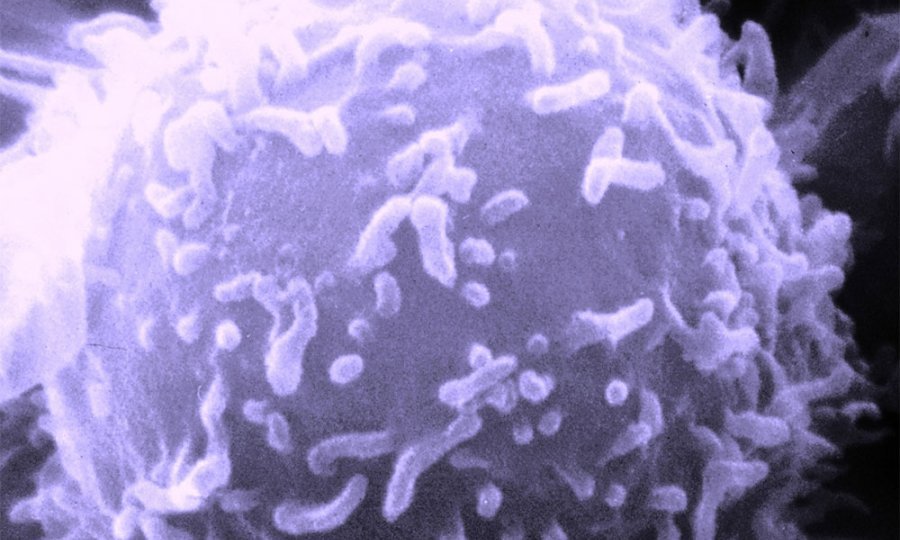 Tumor-rak