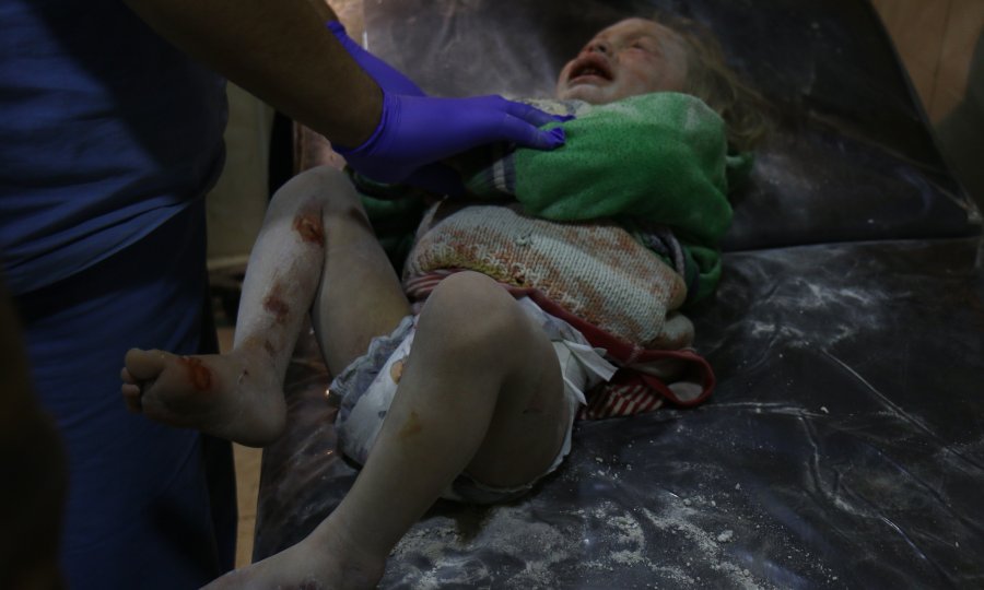 Liječnici u poljskoj bolnici pružaju pomoć djetetu ozlijeđenom u zračnim napadima na sjevernosirijsku pokrajinu Idlib 4. veljače 2018.