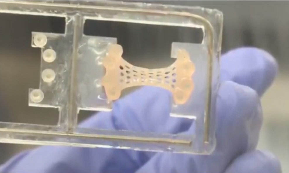 Flaster veličine 3x2 cm uzgojen je u laboratoriju od pacijentova tkiva