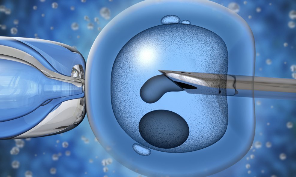 umjetna oplodnja sperma