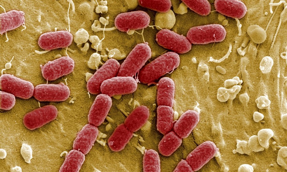 Smrtonosna bakterija Escherichia coli enterohemoragijskog soja (3)