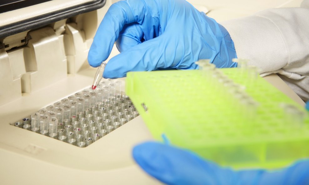 PCR testovi