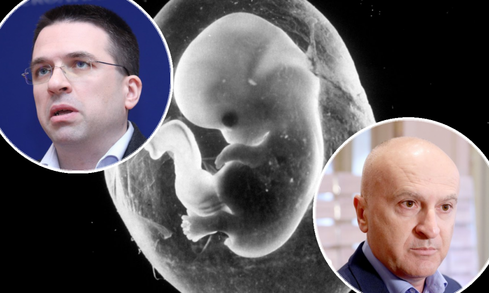 Tomislav Sokol, Predrag Matić; ljudski fetus star osam tjedana