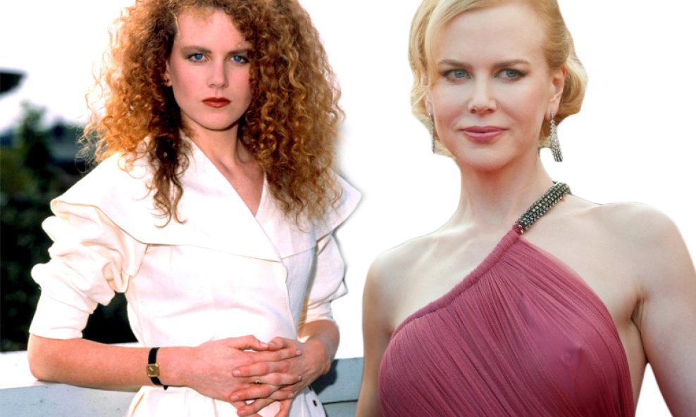 Nicole Kidman