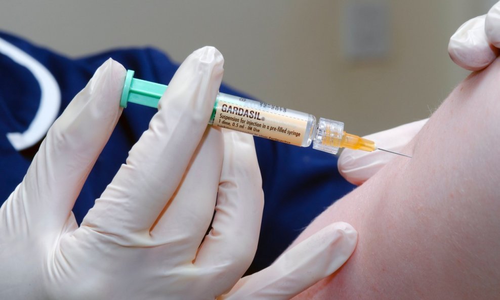Cijepljnje protiv HPV-a