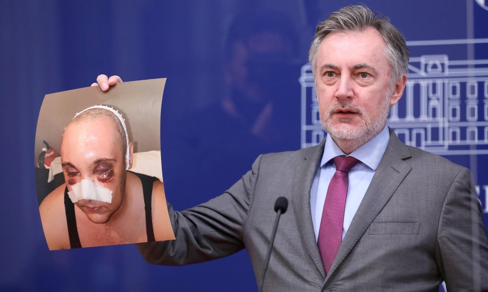Miroslav Škoro