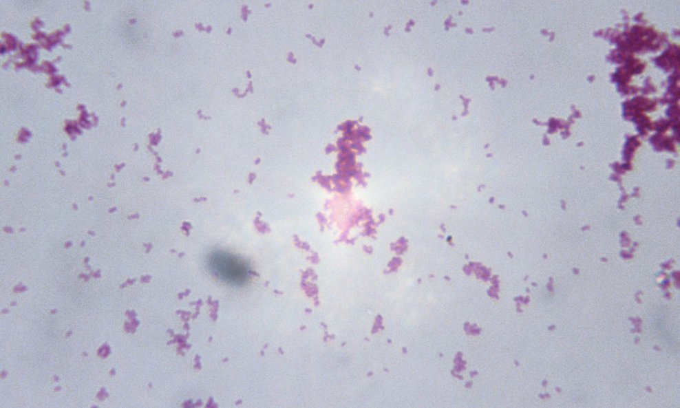 Bakterija Neisseria gonorrhoeae