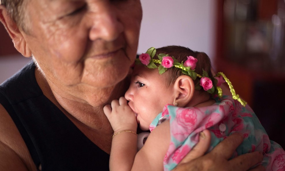 Posljedice Zika virusa na bebe