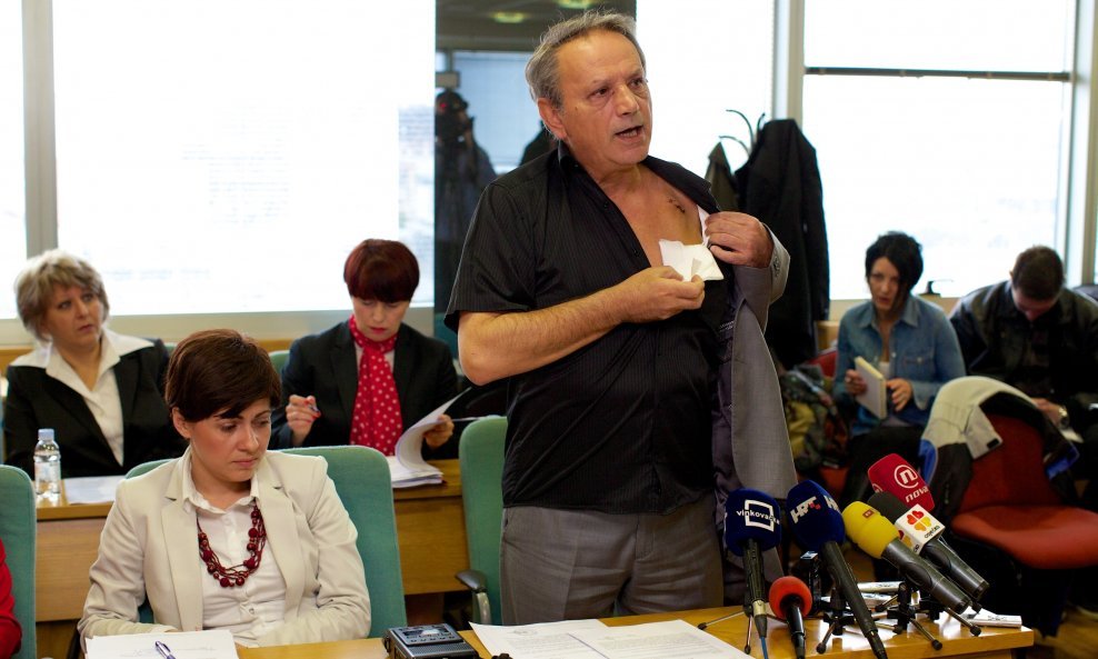 Željko Sabo raskopčao košulju