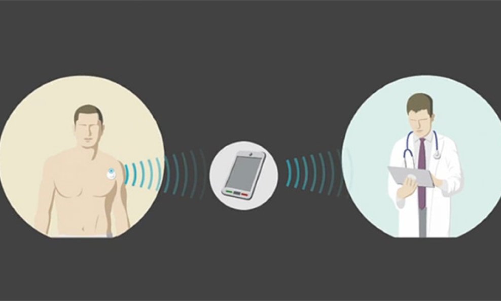 EPFL implantat