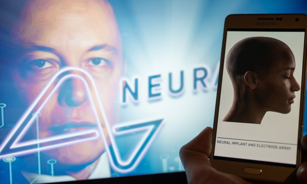 Neuralink