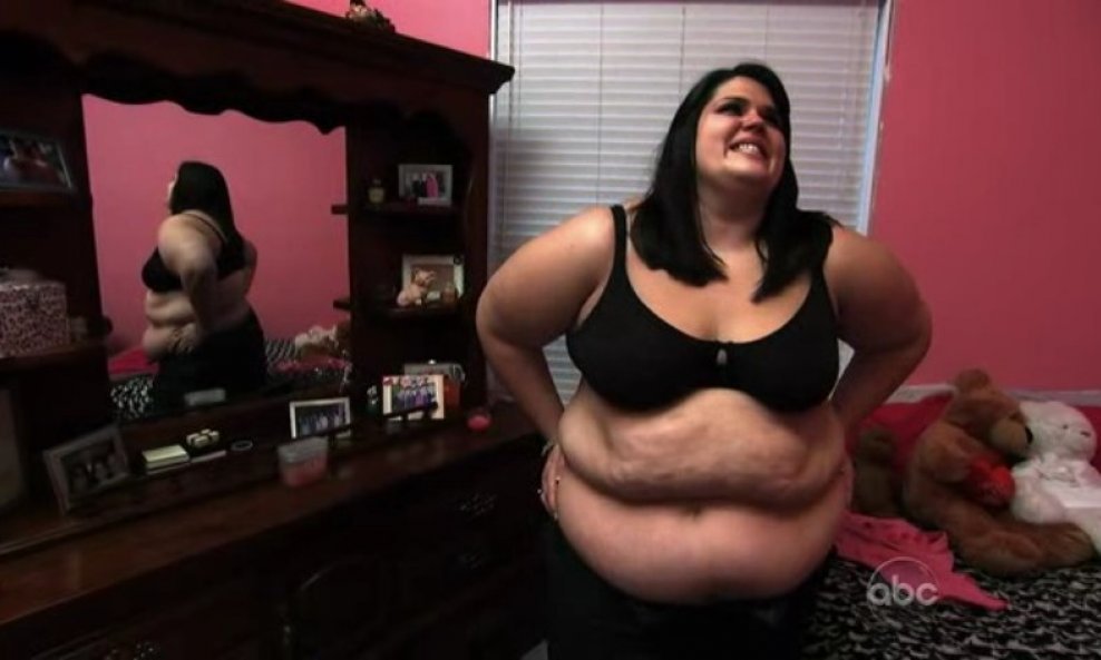 'Extreme Makeover Weight Loss Edition'