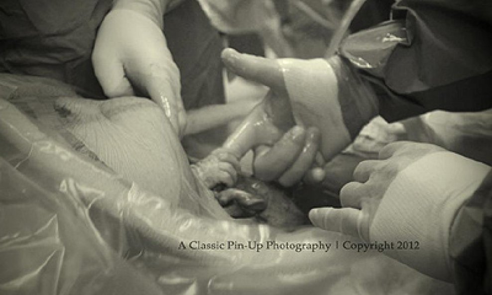 Neaveh Atkins beba kirurg