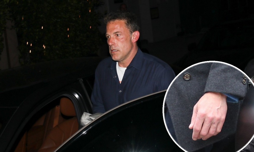 Ben Affleck bez vjenčanog prstena
