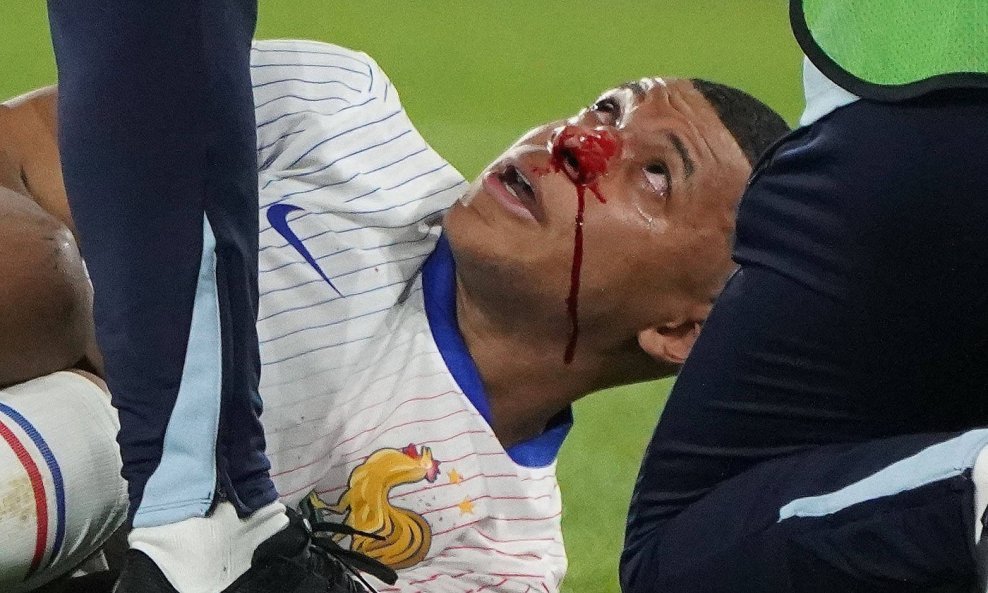 Kylian Mbappe