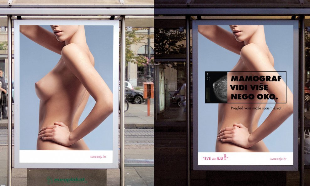 Kampanja 'Mamografija vidi više nego oko'