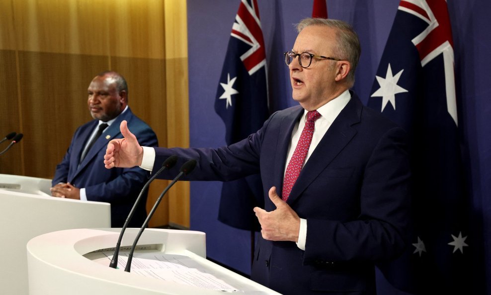Anthony Albanese
