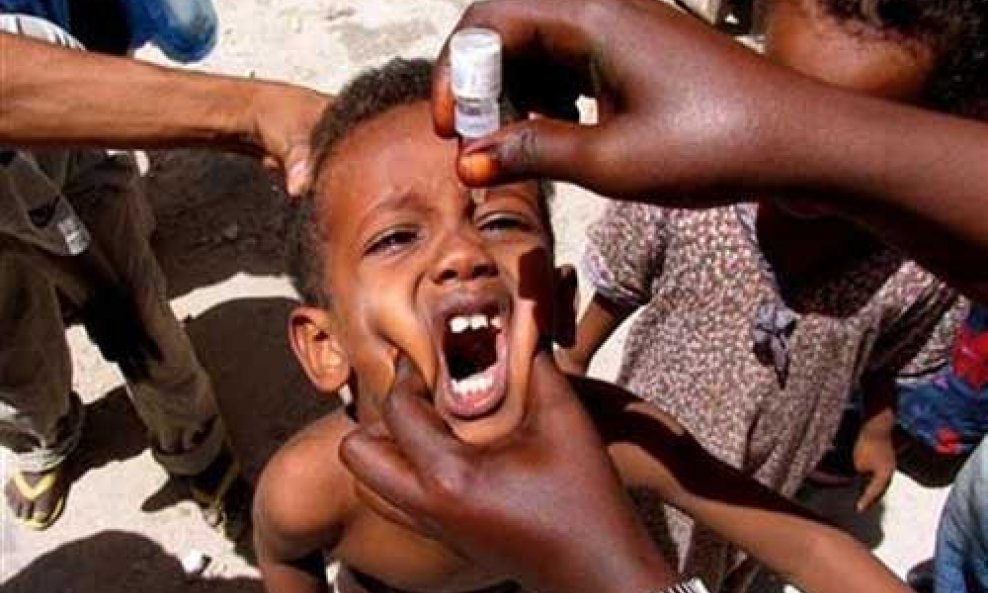 Dječja paraliza polio