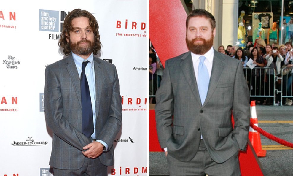 Zach Galifianakis