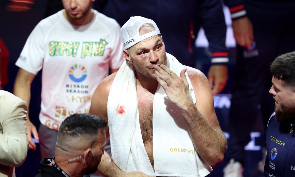 Tyson Fury