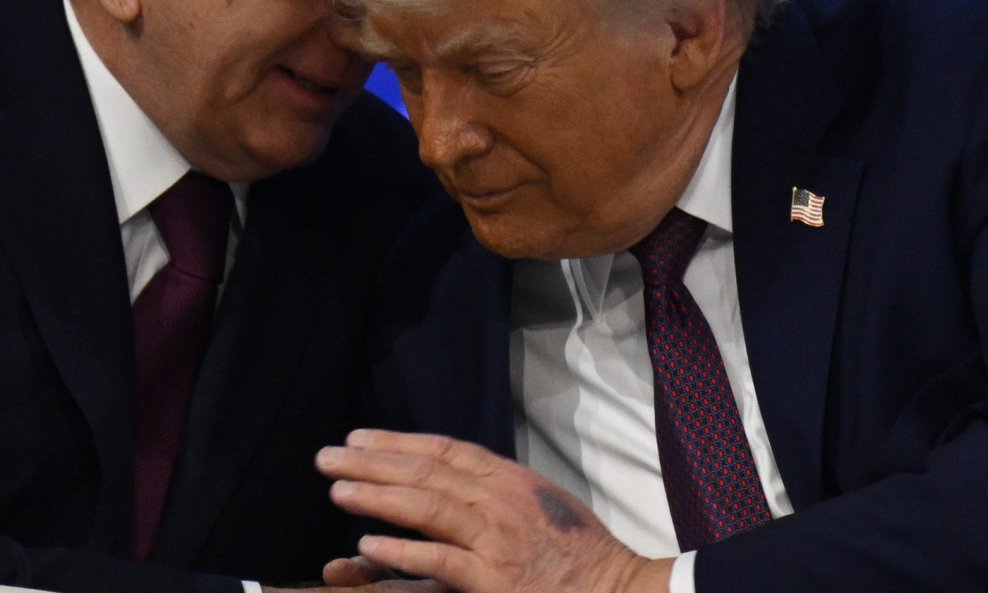 Trump se zna pojaviti s modricama na rukama