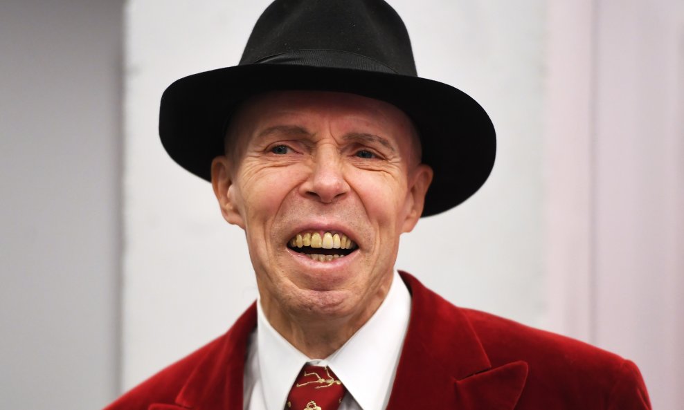 Gunther von Hagens