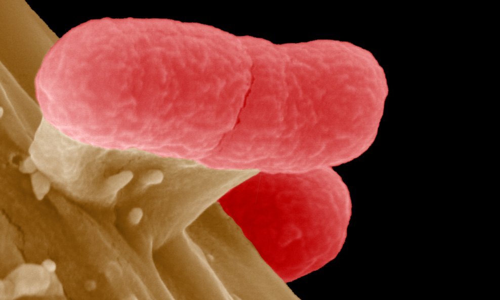 Smrtonosna bakterija Escherichia coli enterohemoragijskog soja (1)