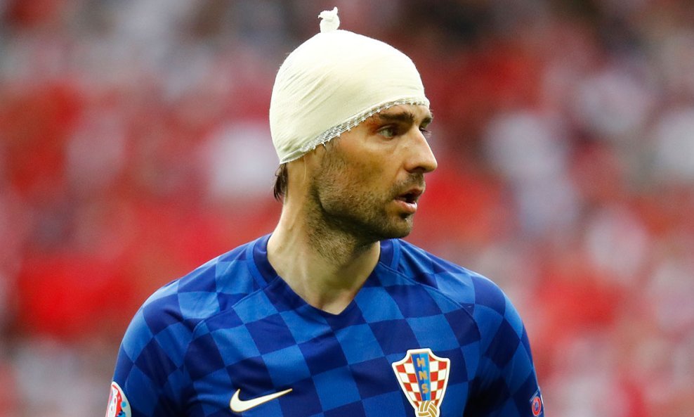 Vedran Ćorluka na Euru u Francuskoj igrao s vaterpolskom kapicom 11