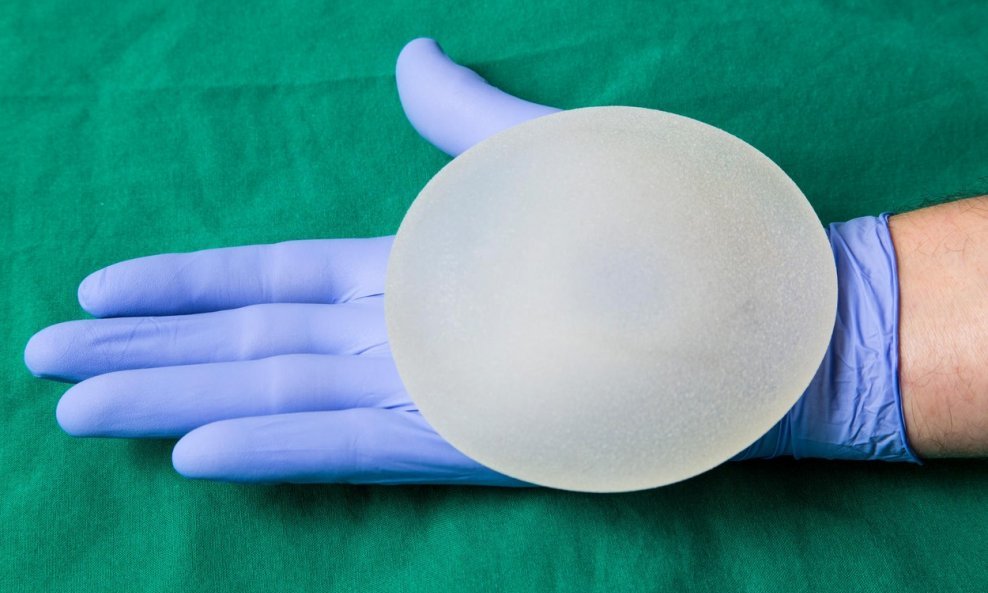 silikonski implanti za grudi