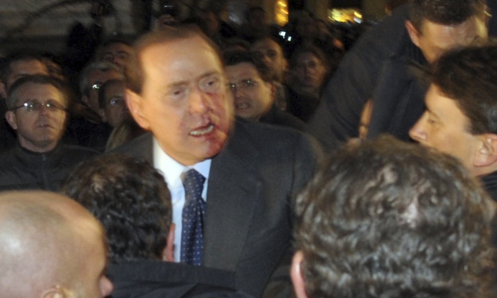 BERLUSCONI KRV NAPAD